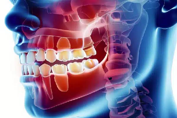 Oral and Maxillofacial Surgery